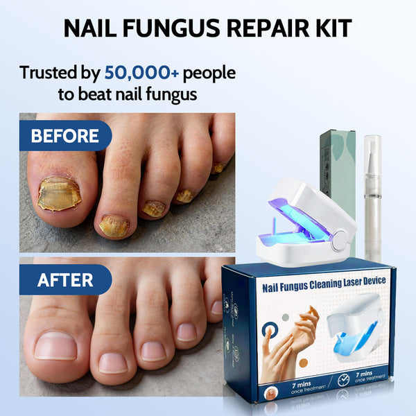 Relix7™ Nail Fungus Repair Kit